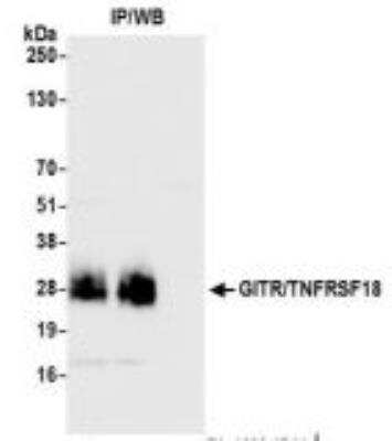 Immunoprecipitation: GITR/TNFRSF18 Antibody [NBP3-14683] - Whole cell lysate (1.0 mgper IP reaction; 20% of IP loaded) from MJ cells preparedusing NETN lysis buffer. Antibodies: Rabbit antiGITR/TNFRSF18 recombinant monoclonal antibody used for IP at 6 ul per reaction.GITR/TNFRSF18 was also immunoprecipitated by rabbitanti-GITR/TNFRSF18 recombinant monoclonal antibody. For blotting immunoprecipitatedGITR/TNFRSF18,was used at 1:1000.Chemiluminescence with an exposure time of 3 seconds.