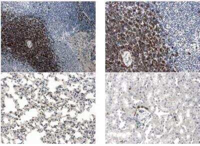 Immunohistochemistry-Paraffin: GITR/TNFRSF18 Antibody (RM0066-7C13) [NBP2-12338] - 4% PFA fixed/Paraffin embedded mouse Spleen, Lung and Kidney sections from LPS treated mice was subjected to immunohistochemistry staining (DAB) of GITR.