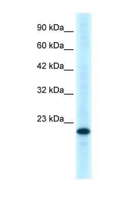 Western Blot: GITR/TNFRSF18 Antibody [NBP1-79933] - Hela cell lysate, Antibody Titration: 0.2-1 ug/ml