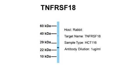 Western Blot: GITR/TNFRSF18 Antibody [NBP1-79933] - Sample Tissue: Human HCT116 Antibody Dilution: 1.0 ug/ml