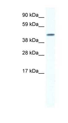 Western Blot: GJA5 Antibody [NBP1-59204] - Titration: 0.2-1 ug/ml, Positive Control: Human Lung.