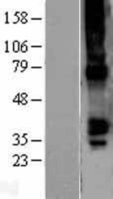 Western Blot: GJA5 Overexpression Lysate (Adult Normal) [NBL1-11089] Left-Empty vector transfected control cell lysate (HEK293 cell lysate); Right -Over-expression Lysate for GJA5.