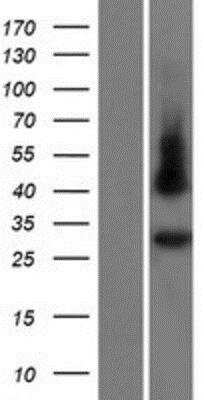 Western Blot: GJC3 Overexpression Lysate (Native) [NBP2-04911] - GJC3 Overexpression Lysate (Native) Left-Empty vector transfected control cell lysate (HEK293 cell lysate); Right -Over-expression Lysate for GJE1.