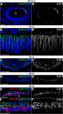 Immunohistochemistry-Paraffin: GJE1 Antibody [NBP2-14051] - Staining of GJE1 in human fetal cochlea using anti-GJE1 antibody. Image from verified customer review.
