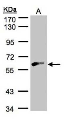 Western Blot: GK2 Antibody [NBP1-32210] - Sample(30 ug of whole cell lysate)A:Hep G2 7. 5% SDS PAGE, antibody diluted at 1:500.