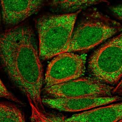 Immunocytochemistry/Immunofluorescence: GK5 Antibody [NBP2-58312] - Staining of human cell line SiHa shows localization to nucleoplasm & cytosol.