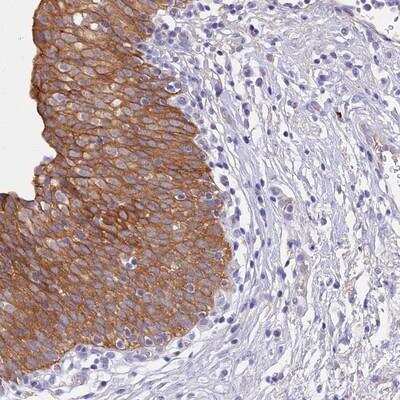 Immunohistochemistry-Paraffin: GK5 Antibody [NBP1-82692] - Staining of human urinary bladder shows moderate cytoplasmic and membranous positivity in urothelial cells.