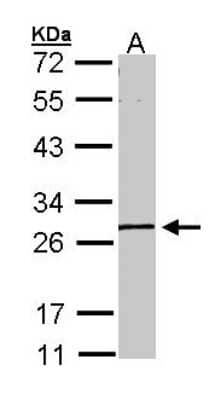 Western Blot: GK5 Antibody [NBP1-32863] - Sample (30 ug of whole cell lysate) A: A431 10% SDS PAGE; antibody diluted at 1:1000.