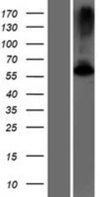 Western Blot: GK5 Overexpression Lysate (Adult Normal) [NBP2-08577] Left-Empty vector transfected control cell lysate (HEK293 cell lysate); Right -Over-expression Lysate for GK5.