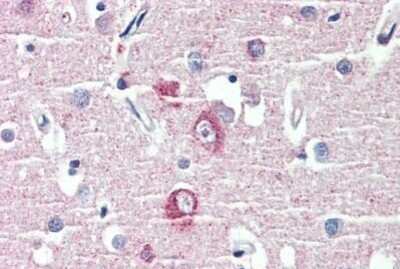 Immunohistochemistry-Paraffin: GKAP/DLGAP1 Antibody [NBP1-52557] - Analysis of anti-DLGAP1 antibody with human brain, cortex at concentration 3.75 ug/ml.