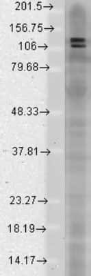 Western Blot: GKAP/DLGAP1 Antibody (S127-31) [NBP1-47612] - analysis of Rat brain membrane lysate showing detection of SAPAP protein using Mouse Anti-SAPAP Monoclonal Antibody, Clone S127-31 . Load: 15 ug protein. Block: 1.5% BSA for 30 minutes at RT. Primary Antibody: Mouse Anti-SAPAP Monoclonal Antibody at 1:1000 for 2 hours at RT. Secondary Antibody: Sheep Anti-Mouse IgG: HRP for 1 hour at RT.