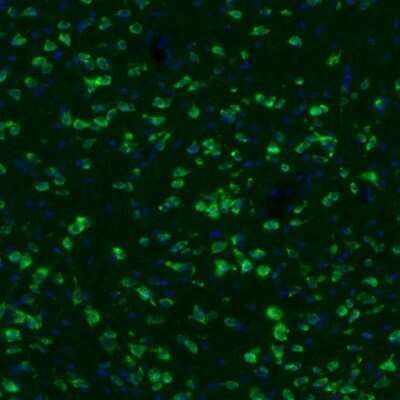 Immunohistochemistry: GKAP1 Antibody [NBP2-33989] - Staining of mouse periaqueductal grey shows immunoreactivity in neuronal cell bodies.