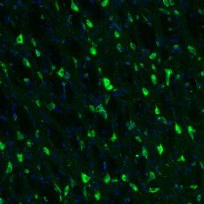 Immunohistochemistry: GKAP1 Antibody [NBP2-33989] -  Staining of mouse forebrain shows neuronal positivity in globus pallidus.