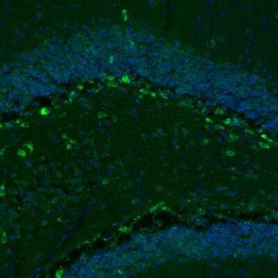 Immunohistochemistry: GKAP1 Antibody [NBP2-33989] - Staining of mouse hippocampus shows immunoreactivity in a subset of neurons in the polymorph layer.