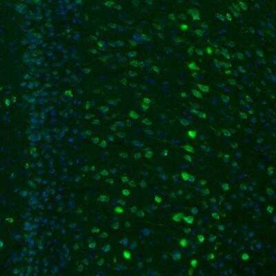 Immunohistochemistry: GKAP1 Antibody [NBP2-33989] - Staining of mouse retrosplenial cortex shows positivity in a subset of neurons.
