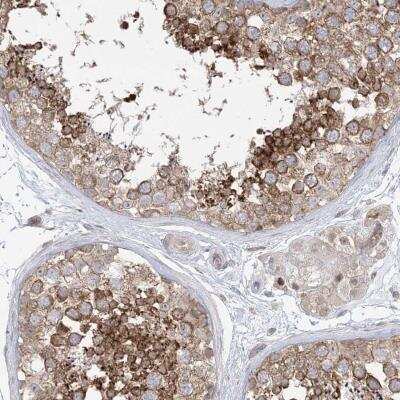 Immunohistochemistry GKAP1 Antibody - BSA Free