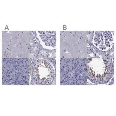 <b>Independent Antibodies Validation. </b>Immunohistochemistry-Paraffin: GKAP1 Antibody [NBP1-84669] - Staining of human cerebral cortex, kidney, pancreas and testis using Anti-GKAP1 antibody NBP1-84669 (A) shows similar protein distribution across tissues to independent antibody NBP2-62650 (B).