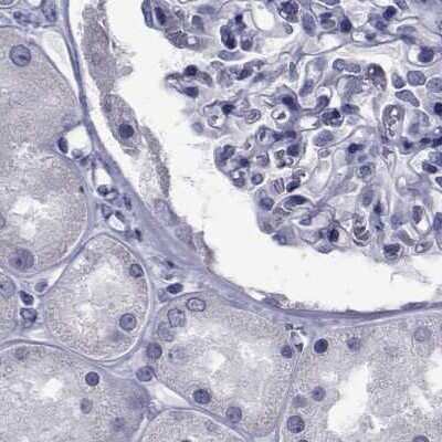 Immunohistochemistry-Paraffin: GKAP1 Antibody [NBP1-84669] - Staining of human kidney.