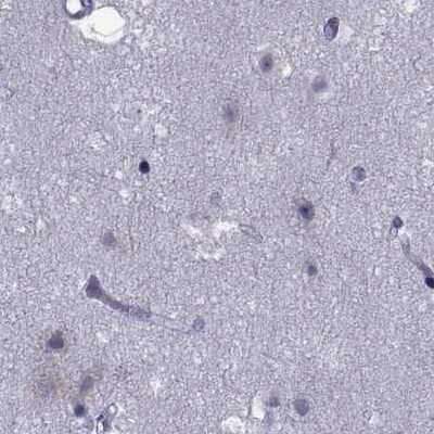 Immunohistochemistry-Paraffin: GKAP1 Antibody [NBP1-84669] - Staining of human cerebral cortex.