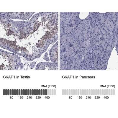 <b>Orthogonal Strategies Validation. </b>Immunohistochemistry-Paraffin: GKAP1 Antibody [NBP2-62650] - Analysis in human testis and pancreas tissues using Anti-GKAP1 antibody. Corresponding GKAP1 RNA-seq data are presented for the same tissues.