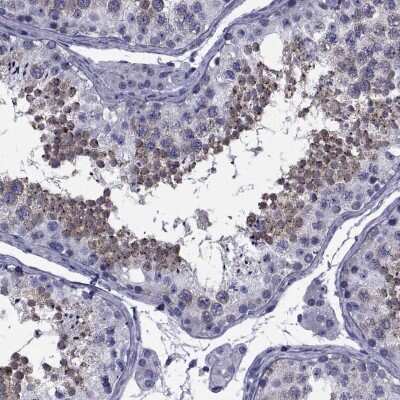 Immunohistochemistry-Paraffin: GKAP1 Antibody [NBP2-62650] - Staining of human testis shows high expression.