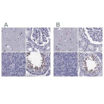 <b>Independent Antibodies Validation. </b>Immunohistochemistry-Paraffin: GKAP1 Antibody [NBP2-62650] - Staining of human cerebral cortex, kidney, pancreas and testis using Anti-GKAP1 antibody NBP2-62650 (A) shows similar protein distribution across tissues to independent antibody NBP1-84669 (B).