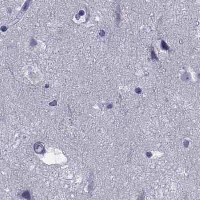 Immunohistochemistry-Paraffin: GKAP1 Antibody [NBP2-62650] - Staining of human cerebral cortex.