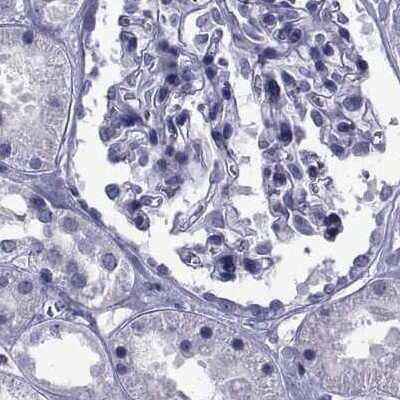 Immunohistochemistry-Paraffin: GKAP1 Antibody [NBP2-62650] - Staining of human kidney.