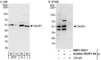 Western Blot: GKAP1 Antibody [NBP1-79017] - Whole cell lysate from 293T(15 and 50 mcg for WB; 1 mg for IP, 20% of IP loaded), HeLa (H; 50 mcg) and Jurkat (J; 50 mcg) cells.   Affinity purified rabbit anti-GKAP1 antibody  used for WB at 0.1 mcg/ml (A) and 1 mcg/ml (B) and used for IP at 6 mcg/mg lysate.  GKAP1 was also immunoprecipitated by another rabbit anti-GKAP1 antibody which recognizes a downstream epitope.