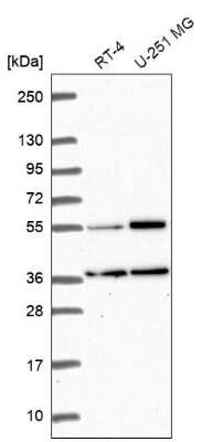 Western Blot GKAP1 Antibody - BSA Free