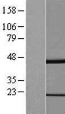 Western Blot GKAP1 Overexpression Lysate