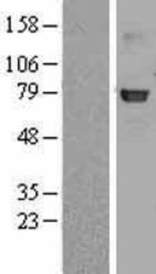 Western Blot beta-Galactosidase-1/GLB1 Overexpression Lysate