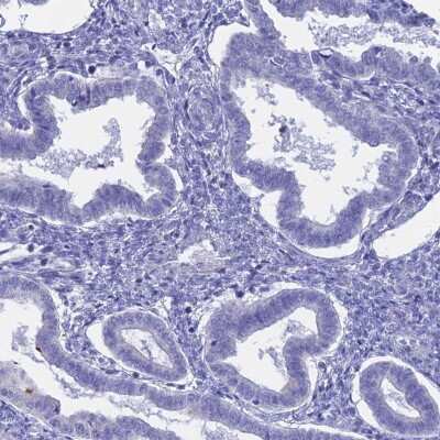 Immunohistochemistry-Paraffin GLB1L Antibody - BSA Free