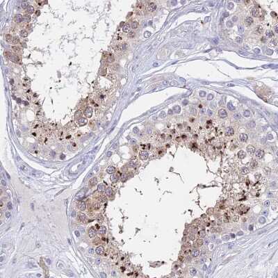 Immunohistochemistry-Paraffin GLB1L Antibody - BSA Free