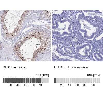 Immunohistochemistry-Paraffin GLB1L Antibody - BSA Free