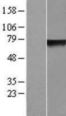 Western Blot: GLB1L Overexpression Lysate (Adult Normal) [NBP2-06325] Left-Empty vector transfected control cell lysate (HEK293 cell lysate); Right -Over-expression Lysate for GLB1L.