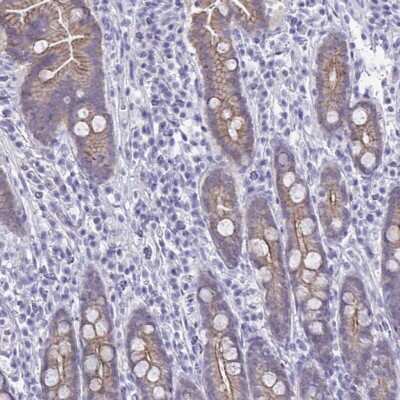 Immunohistochemistry-Paraffin: GLB1L2 Antibody [NBP2-31804] - Staining of human small intestine shows moderate membranous positivity in glandular cells.
