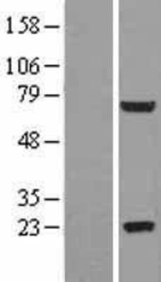 Western Blot: GLB1L2 Overexpression Lysate (Adult Normal) [NBL1-11107] Left-Empty vector transfected control cell lysate (HEK293 cell lysate); Right -Over-expression Lysate for GLB1L2.