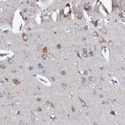 Immunohistochemistry: GLB1L3 Antibody [NBP2-48716] - Staining of human cerebral cortex shows moderate cytoplasmic positivity in neuronal cells.