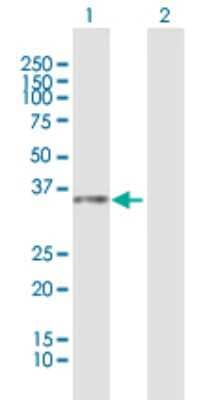 Western Blot: GLB1L3 Antibody [H00112937-B01P] - Analysis of LOC112937 expression in transfected 293T cell line by LOC112937 polyclonal antibody.  Lane 1: LOC112937 transfected lysate(34.43 KDa). Lane 2: Non-transfected lysate.