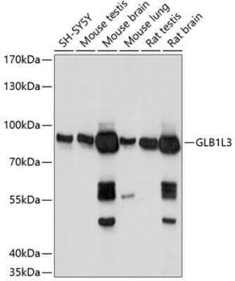 Western Blot GLB1L3 Antibody - Azide and BSA Free