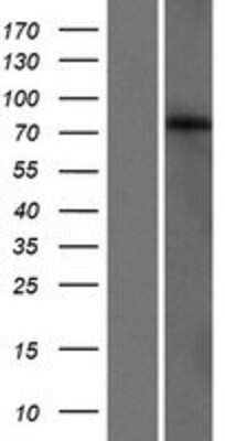 Western Blot: GLB1L3 Overexpression Lysate (Adult Normal) [NBP2-08486] Left-Empty vector transfected control cell lysate (HEK293 cell lysate); Right -Over-expression Lysate for GLB1L3.