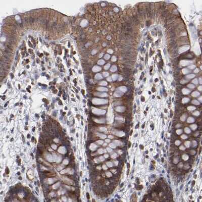 Immunohistochemistry-Paraffin: GLCCl1 Antibody [NBP1-87939] - Staining of human colon shows moderate to strong cytoplasmic positivity in glandular cells.