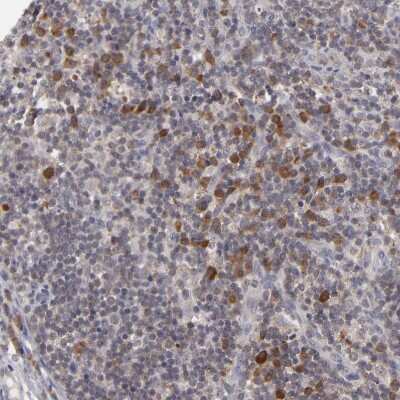 Immunohistochemistry-Paraffin: GLCCl1 Antibody [NBP1-87939] - Staining of human lymph node shows moderate to strong cytoplasmic positivity in non-germinal center cells.