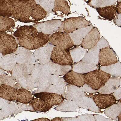 Immunohistochemistry-Paraffin GLCCl1 Antibody - BSA Free