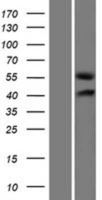 Western Blot: GLCCl1 Overexpression Lysate (Adult Normal) [NBP2-05671] Left-Empty vector transfected control cell lysate (HEK293 cell lysate); Right -Over-expression Lysate for GLCCl1.
