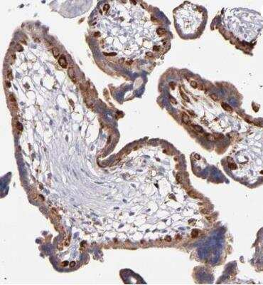 Immunohistochemistry-Paraffin: GLDC Antibody [NBP1-83374] - Staining of human placenta shows cytoplasmic positivity in trophoblastic cells.