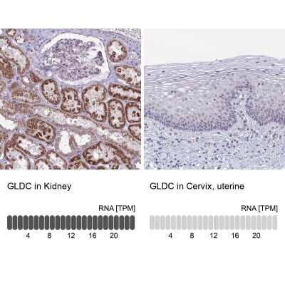 Immunohistochemistry-Paraffin: GLDC Antibody [NBP2-38682] - Analysis in human kidney and cervix, uterine tissues using NBP2-38682 antibody. Corresponding GLDC RNA-seq data are presented for the same tissues.