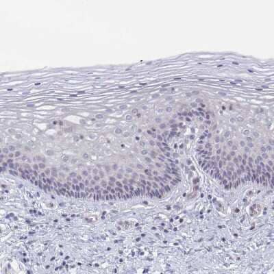 Immunohistochemistry-Paraffin: GLDC Antibody [NBP2-38682] - Staining of human cervix shows no positivity in squamous epithelial cells as expected.