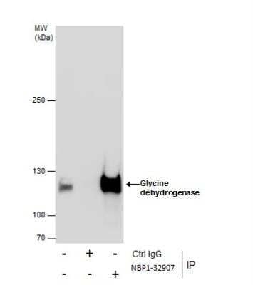 Immunoprecipitation: GLDC Antibody [NBP1-32907] - Immunoprecipitation of Glycine dehydrogenase protein from HepG2 whole cell extracts using 5 ug of Glycine dehydrogenase antibody [N3C2-2], Internal. Western blot analysis was performed using Glycine dehydrogenase antibody [N3C2-2], Internal. EasyBlot anti-Rabbit IgG(was used as a secondary reagent.